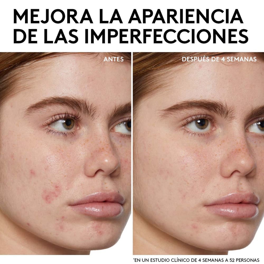 CHERRY DUB TONER (TÓNICO FACIAL)